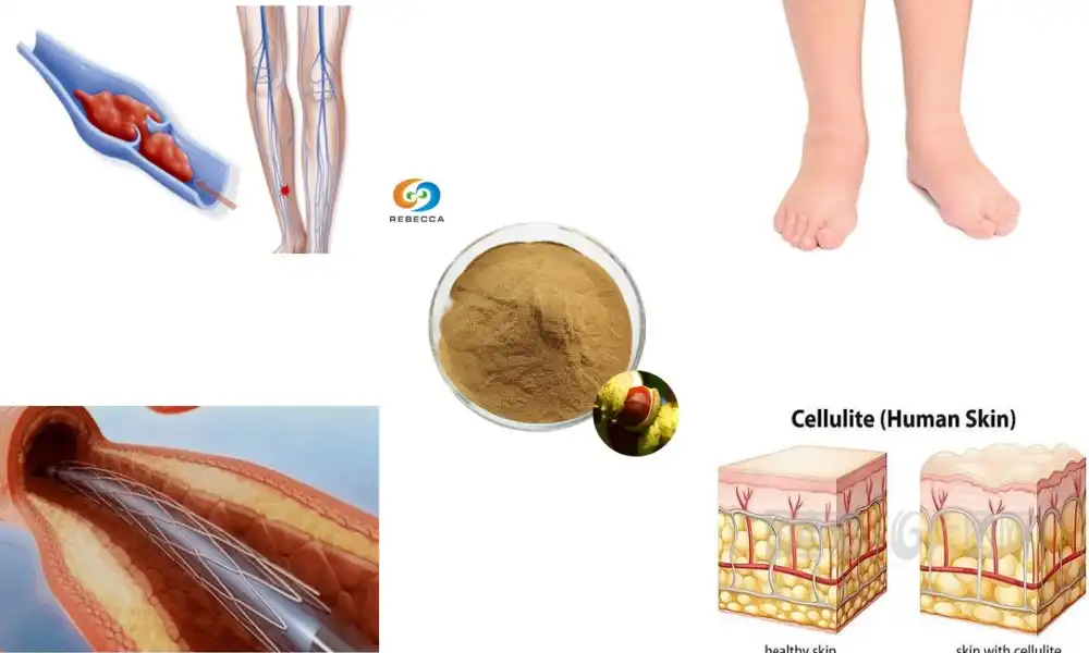 What does horse chestnut seed extract do?